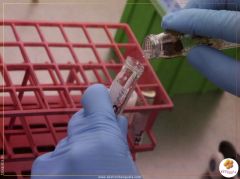 Covid-19: Laboratório de RTPCR de Benguela avariado